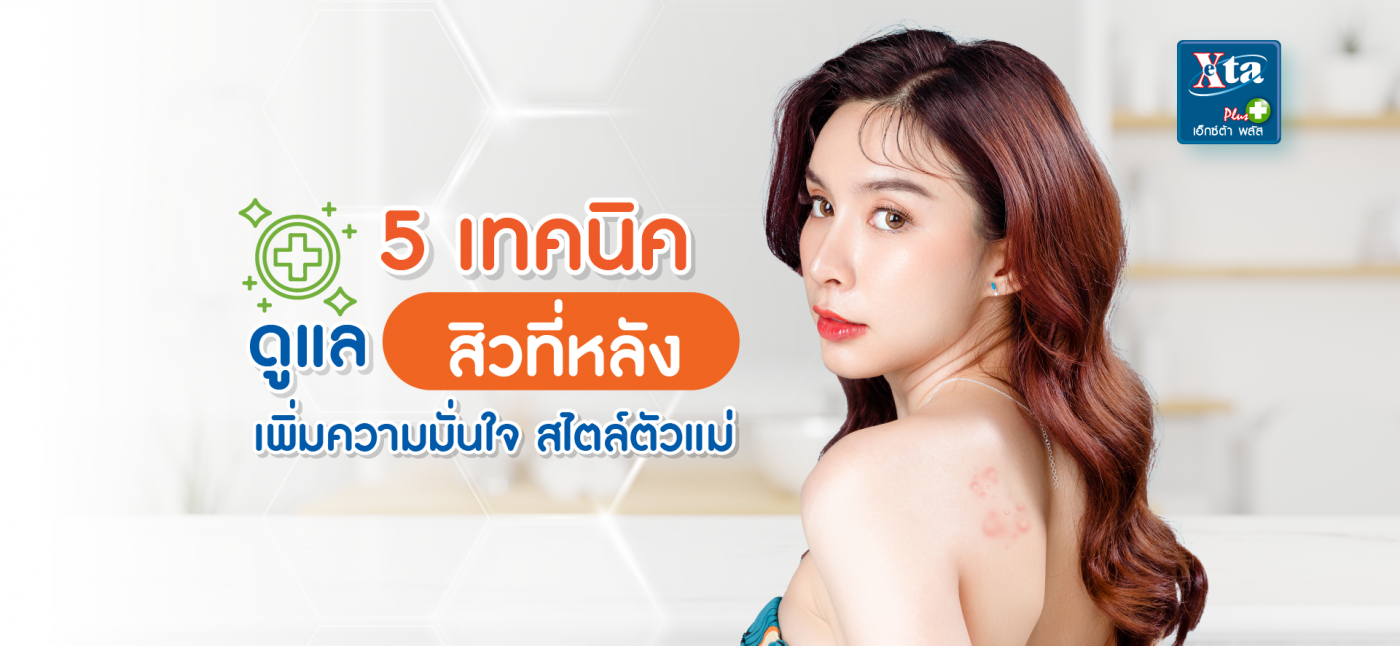 5เทคนิคดูแลสิวที่หลัง