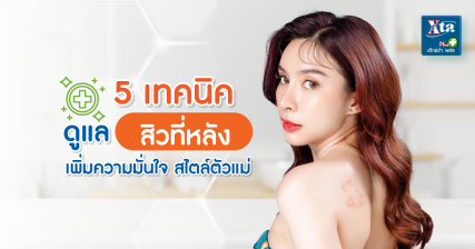 5เทคนิคดูแลสิวที่หลัง